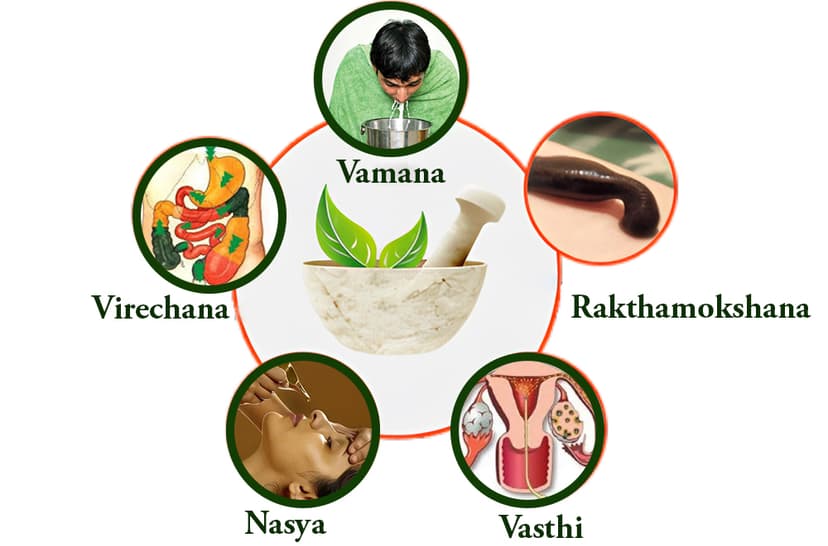 Punchakarma: The Ultimate Ayurvedic Delox Therapy at Ayurmanthra